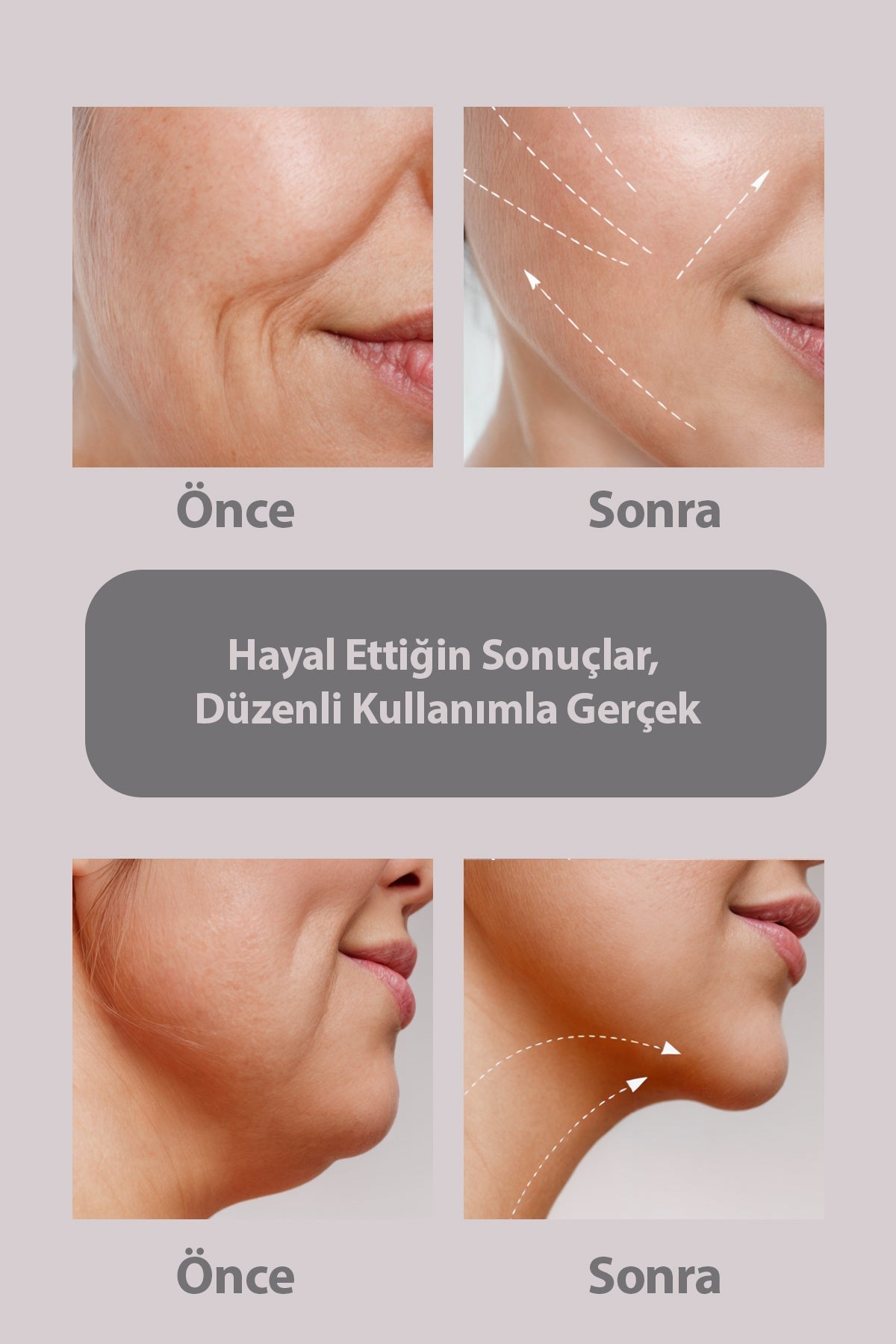 Yüz ve Boyun için Lifting Etkili EMS Cihazı, Gıdık, Sarkma, Yüz ve Boyun Sıkılaştırıcı